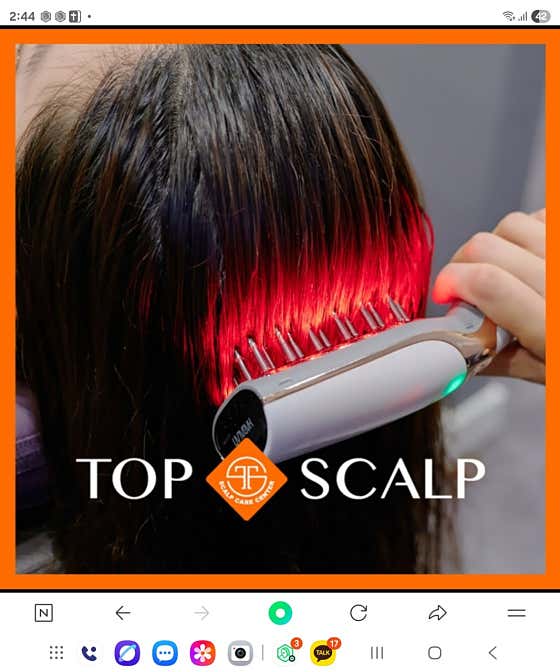 탑스칼프 송파점 쿠폰 두피,탈모관리
