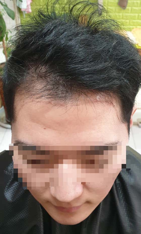 머리하는남자맨