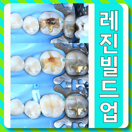 Sinyeongtong Teunteuni Dental Clinic